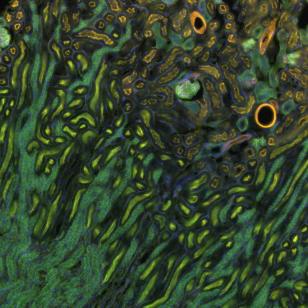 Slide Scanning Services